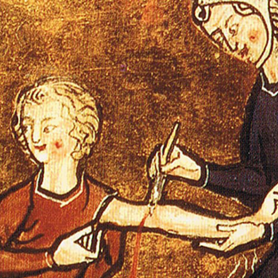 Darstellung eines Aderlasses