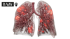 Digitales Modell der Lunge